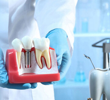 Dental Implant Aftercare: Tips for a Healthy, Long-lasting Smile