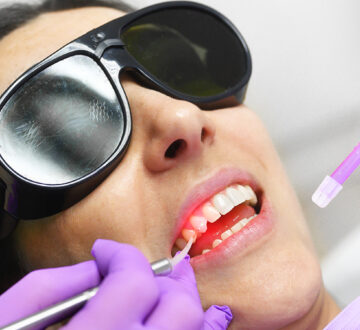 How Fluoride Treatment Can Improve Your Dental Health?