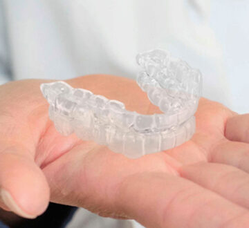 Top Benefits of Choosing Invisalign for Teeth Straightening